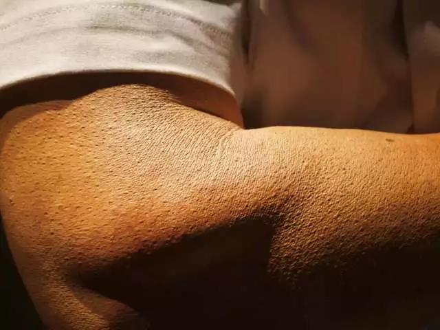20171220103845_8643